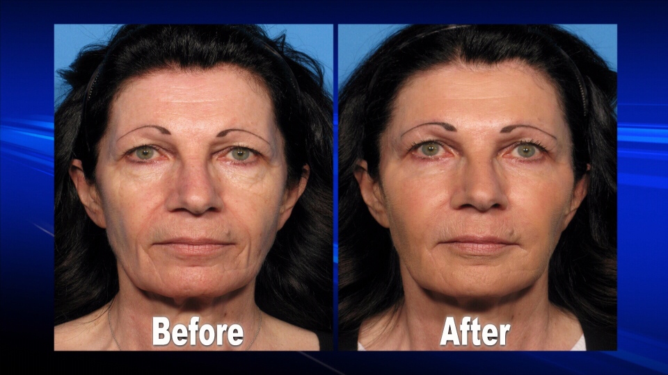 A picture of <b>Carol Krawchuk</b> before and after undergoing a &quot;Lunch-hour <b>...</b> - image