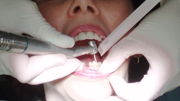 B.C. woman sues dentist wins 15K in damages CTV News