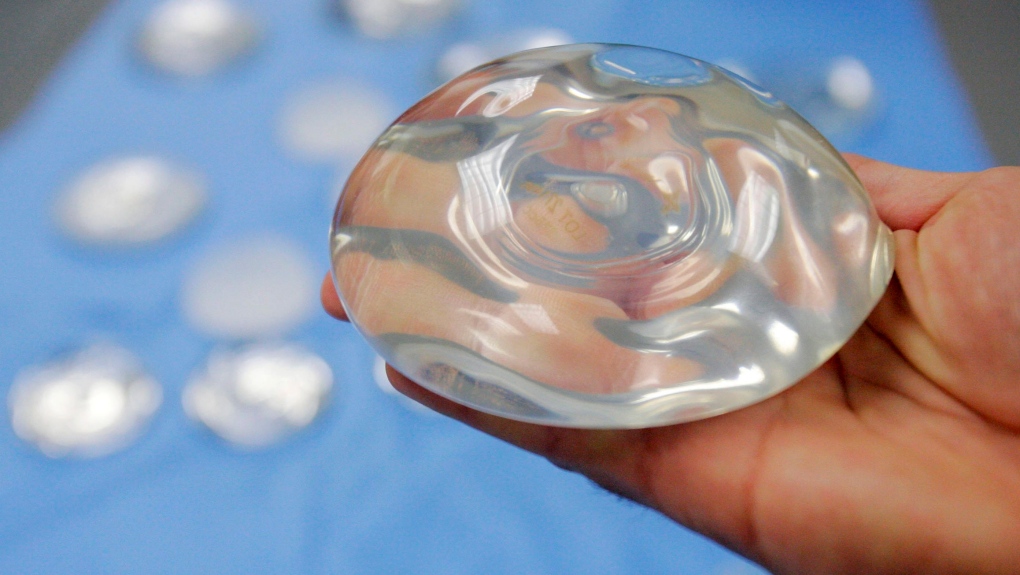 It's B cup or bust: Plastic surgeons tell Moneyish that women want smaller  breast implants - MarketWatch