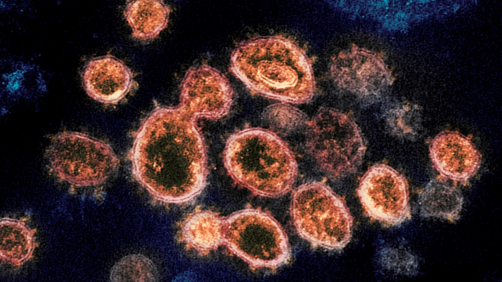 This 2020 electron microscope image provided by the National Institute of Allergy and Infectious Diseases - Rocky Mountain Laboratories shows SARS-CoV-2 virus particles which cause COVID-19, isolated from a patient in the U.S., emerging from the surface of cells cultured in a lab. (NIAID-RML via AP) 