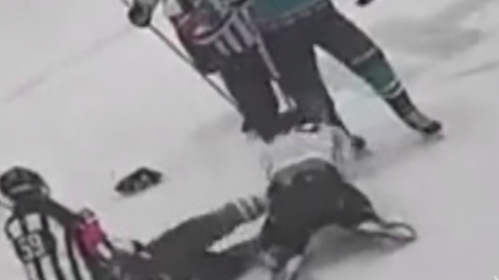 Video Shows Hockey Player Kicked With Skate   Video Shows Hockey Player Kicked With Skate 1 6015206 