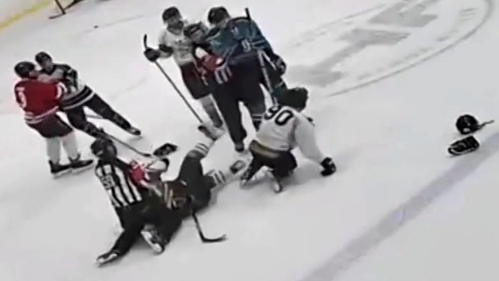 Ontario Hockey League Goalie Severely Cut By Skate In Game, Rushed To  Surgery