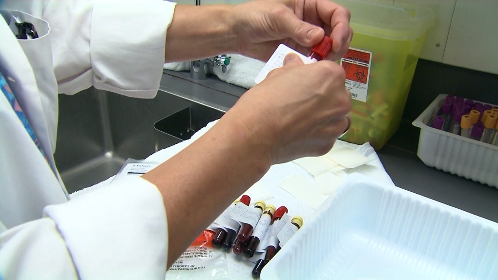 B.C. Doctors Speak Out On Long-COVID Testing